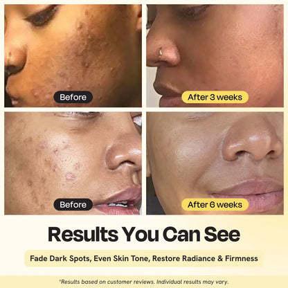Superactive Serum by Gleamin