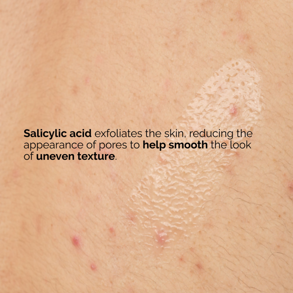 The Ordinary Salicylic Acid 0.5% Body Serum by Dista