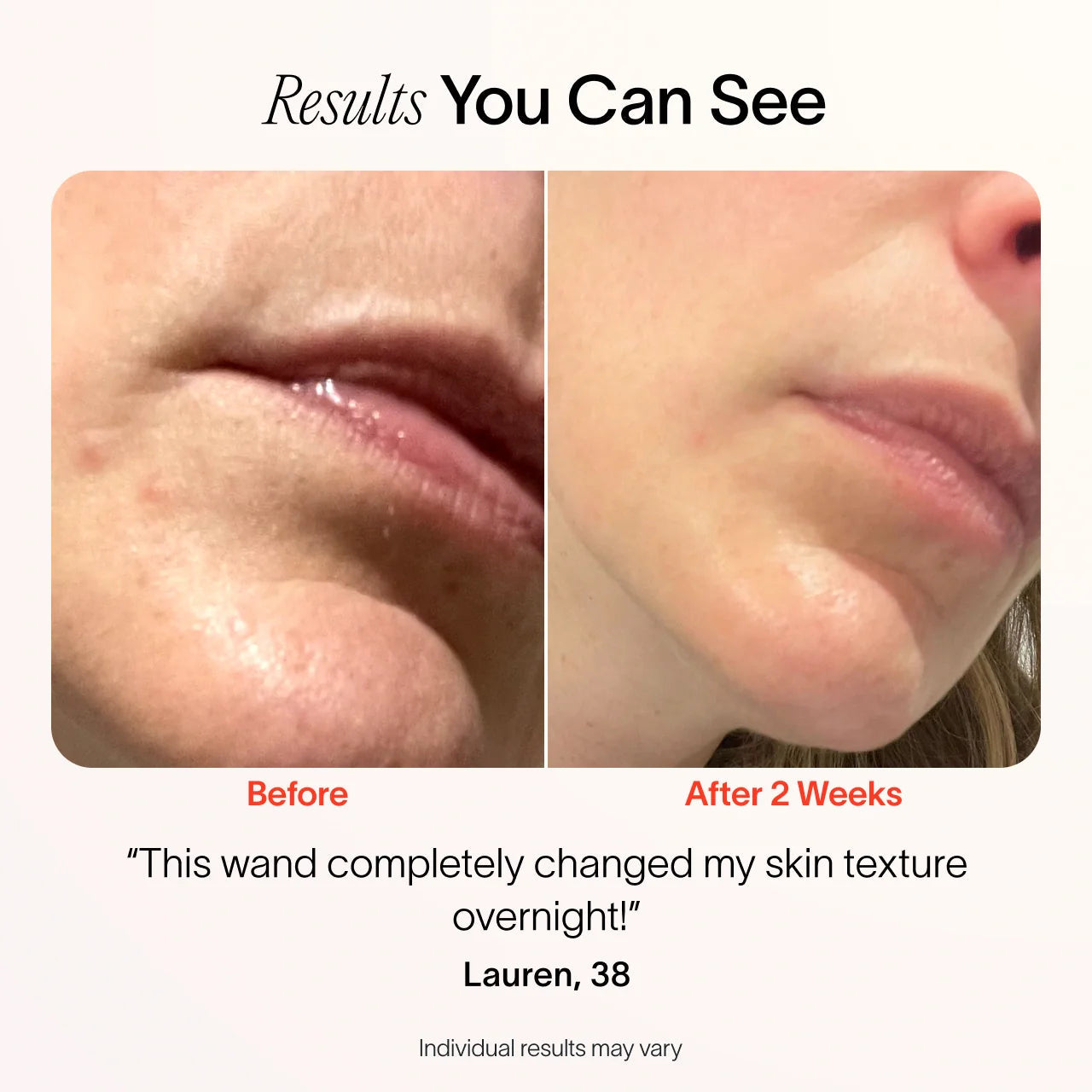 4-In-1 Radiant Renewal Skincare Wand with Red Light Therapy by Korean Skin Care