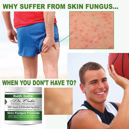 11 - Dr. Cole’s Organic Anti-fungal Skin Soaking Salts by COLEHERBALS LLC