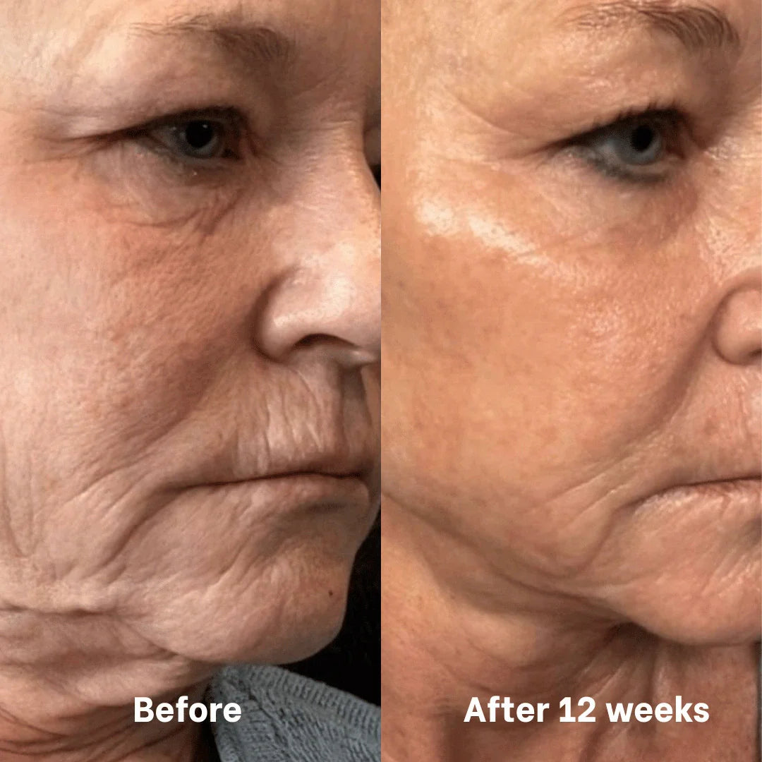 Collagen &amp; Niacinamide wrapping mask by Skynflow