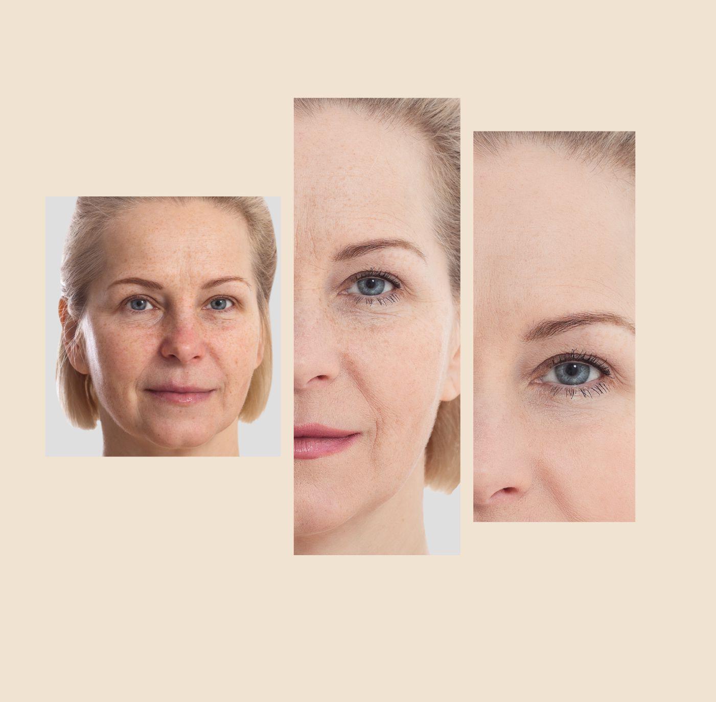 The Eraser Spot Cream | Dark Spot Corrector by gymsegbë