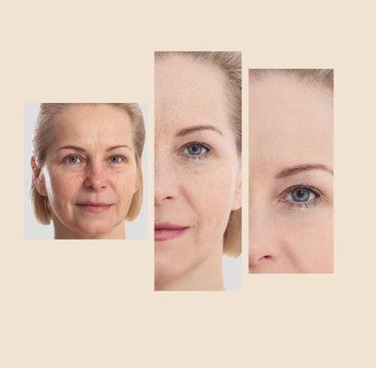 The Eraser Spot Cream | Dark Spot Corrector by gymsegbë