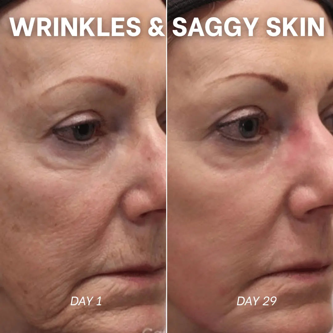 PDRN Collagen Peptide Hydrogel Mask by Skynflow