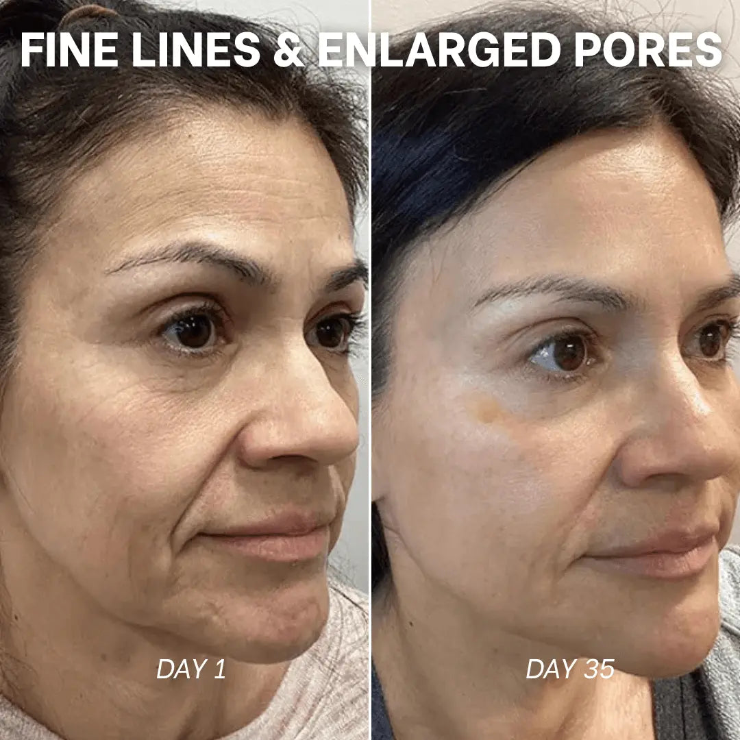 PDRN Collagen Peptide Hydrogel Mask by Skynflow