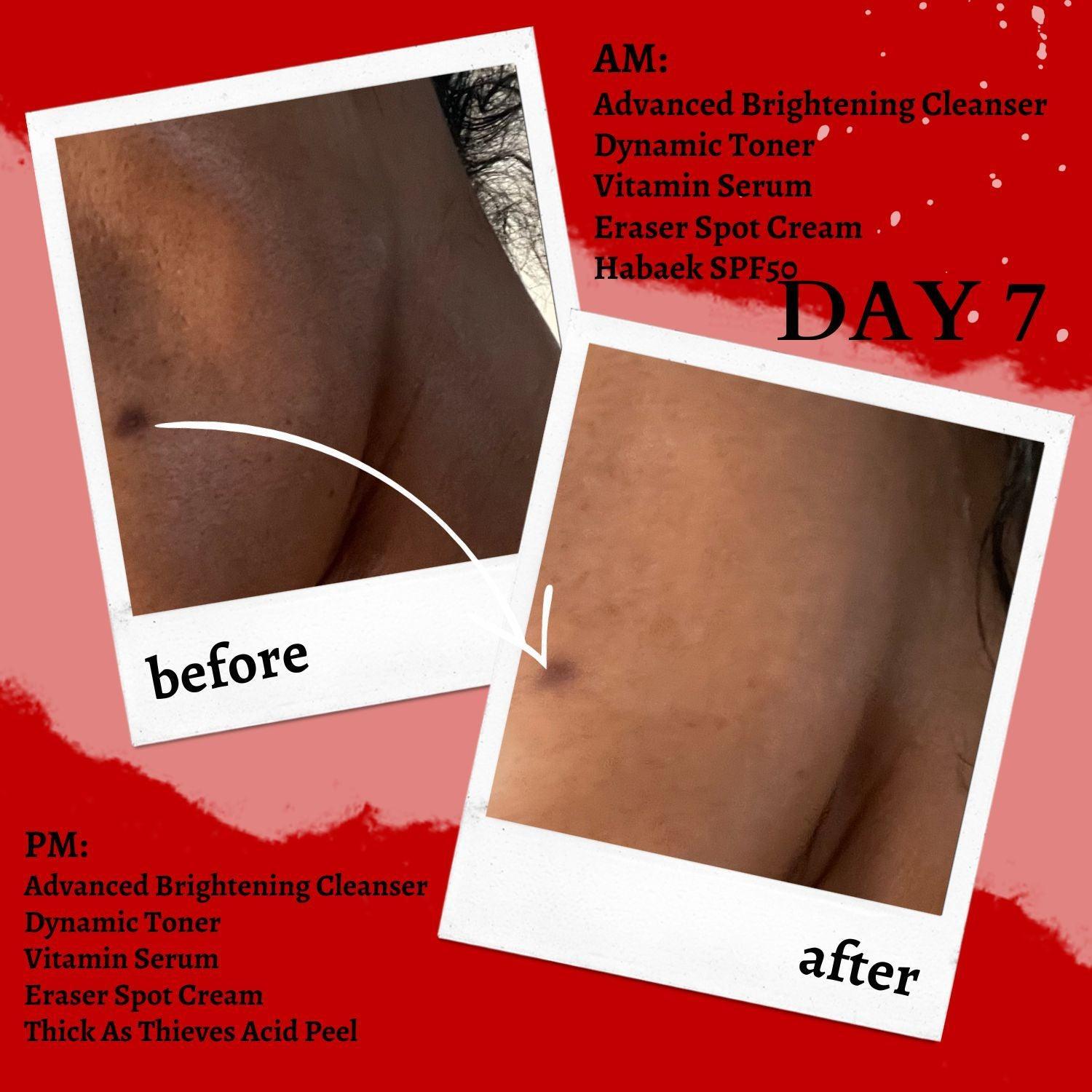 Thick As Thieves Pure Glycolic Acid Lactic Acid Extreme Gel Peel - 30ml by gymsegbë
