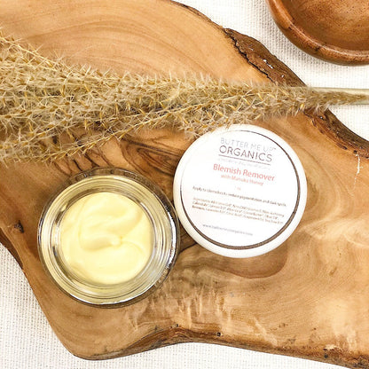 Organic Blemish Cream/ Dark Spot Remover / Scar Cream / Acne Spot Treatment by Butter Me Up Organics