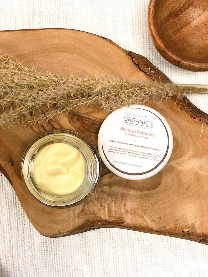 Organic Blemish Cream/ Dark Spot Remover / Scar Cream / Acne Spot Treatment by Butter Me Up Organics