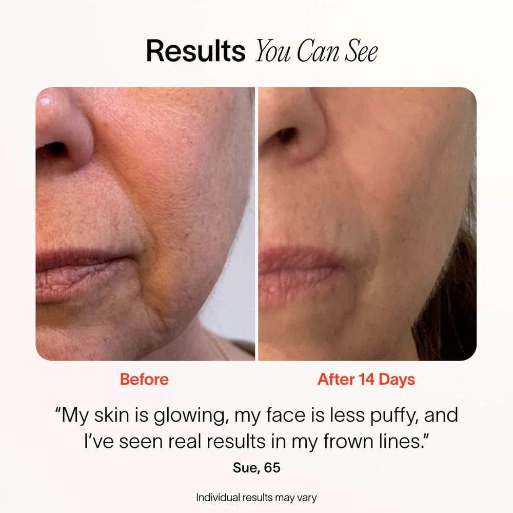 4-In-1 Radiant Renewal Skincare Wand with Red Light Therapy by Korean Skin Care