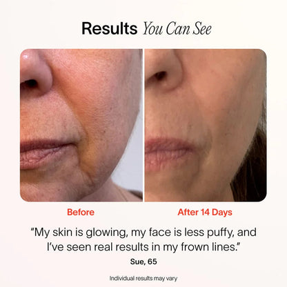 4-In-1 Radiant Renewal Skincare Wand with Red Light Therapy by Korean Skin Care