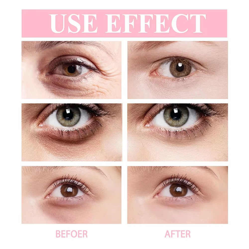Retinol Eye Cream Instant Remove Eye Wrinkles Eye Dark Circles Bags Remover Moisturising Stick Beauty Health Korean Cosmetics by Korean Skin Care