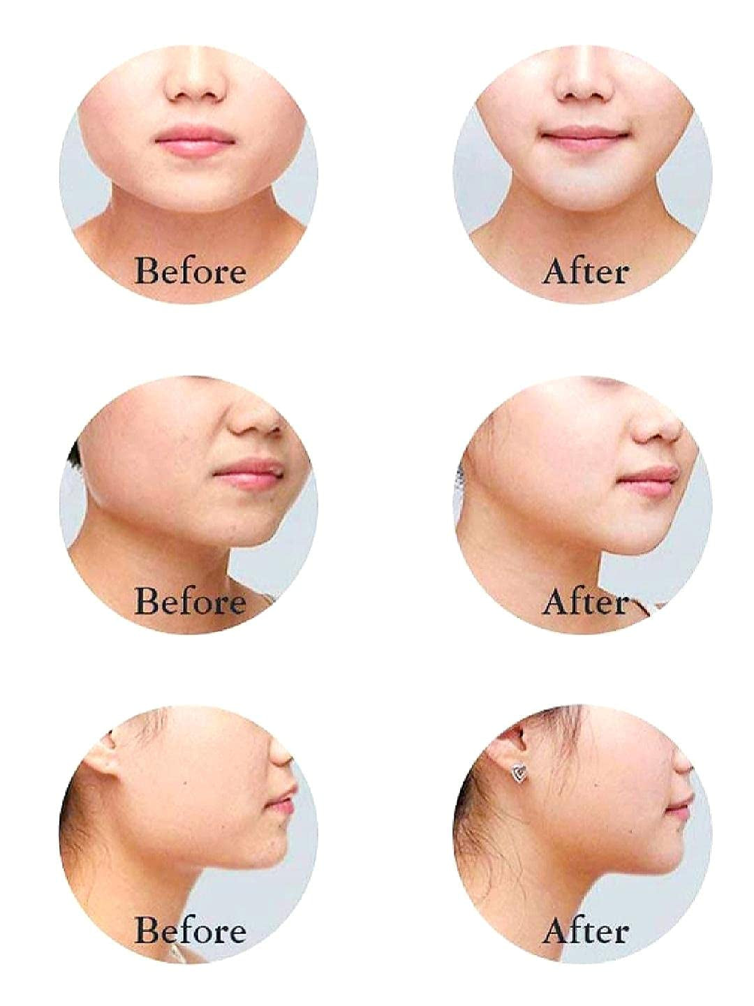 SLIM FACE SLIMMING BAND FACIAL BELT DOUBLE CHIN REDUCER V LINE FACE LIFT anti SNORE WRINKLE FACE BANDAGE DOUBLE CHIN STRAP SAGGING FACE CONTOUR JAWLINE TIGHTEN STRAP 1PK by Korean Skin Care