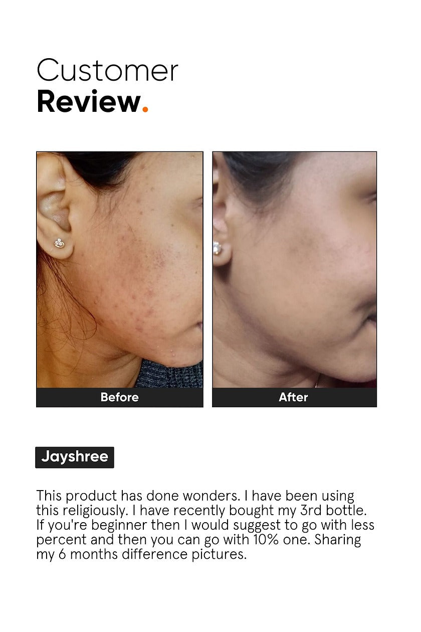 Minimalist 10% Niacinamide Face Serum by Dista