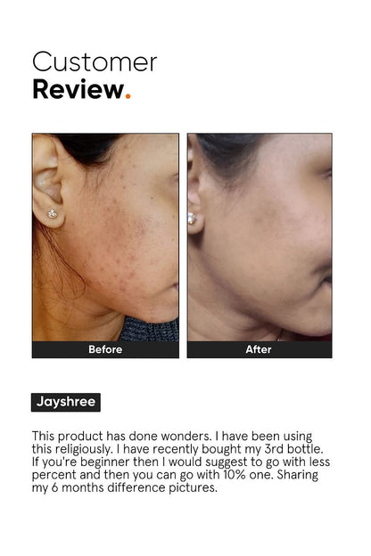 Minimalist 10% Niacinamide Face Serum by Dista