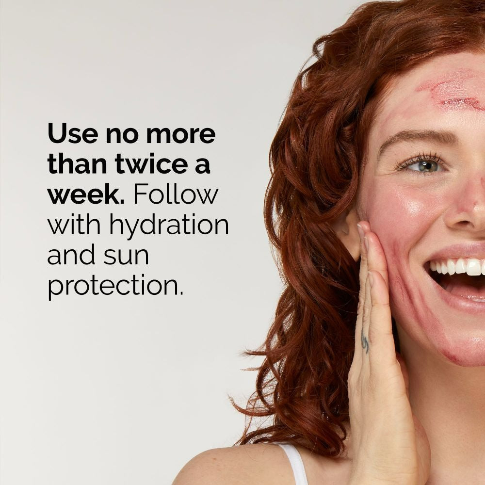 The Ordinary AHA 30% + BHA 2% Peeling Solution Serum by Dista