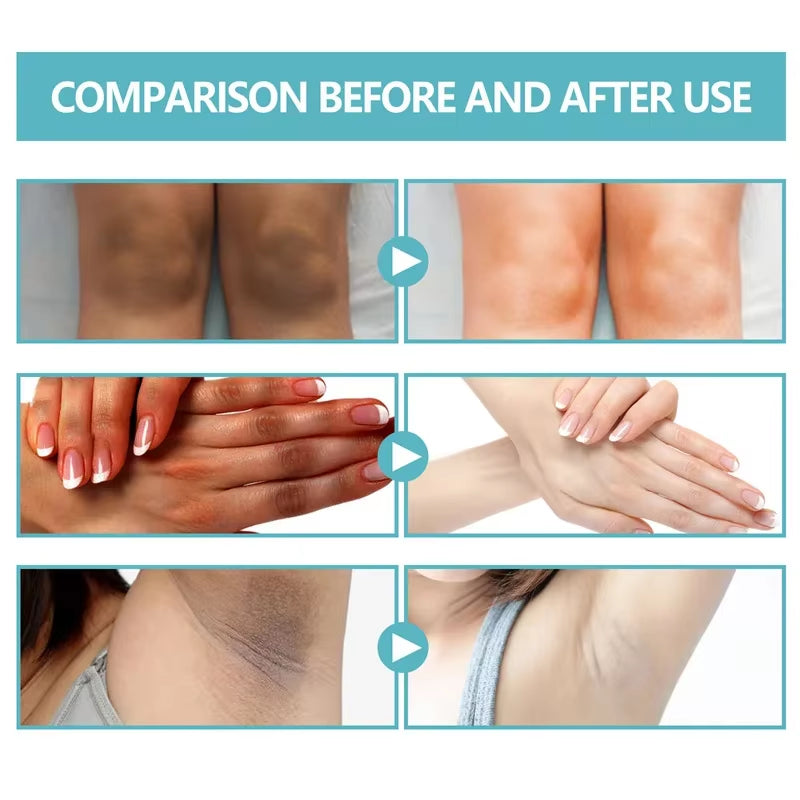 Underarm Creams for Dark Skin Body Crotch Armpit Moisturizing Korean Skincare Products 50G by Korean Skin Care