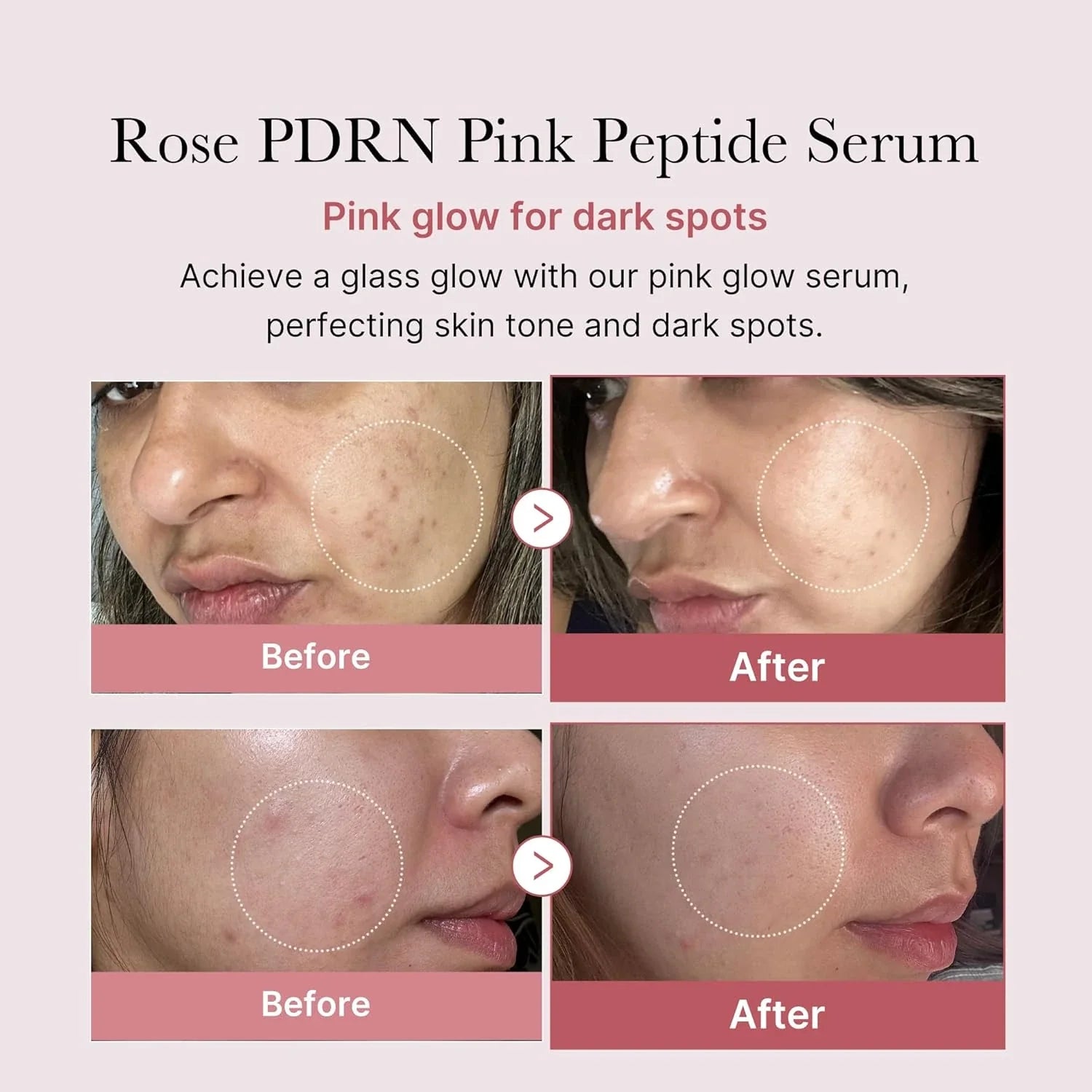 Plumping Serum - Peptides PDRN Niacinamide Retinol by Skynflow
