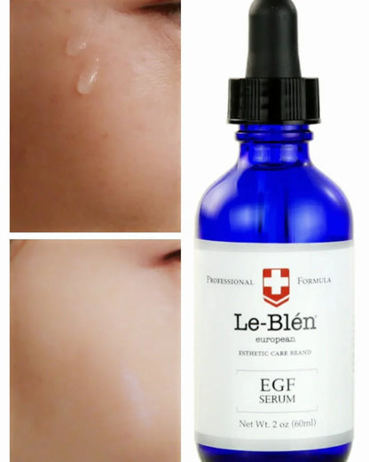 [Le Blen] EGF (Epidermal Growth Factor) Serum ( 4oz) buy one 4 oz get two 1 oz by Pi-Boo
