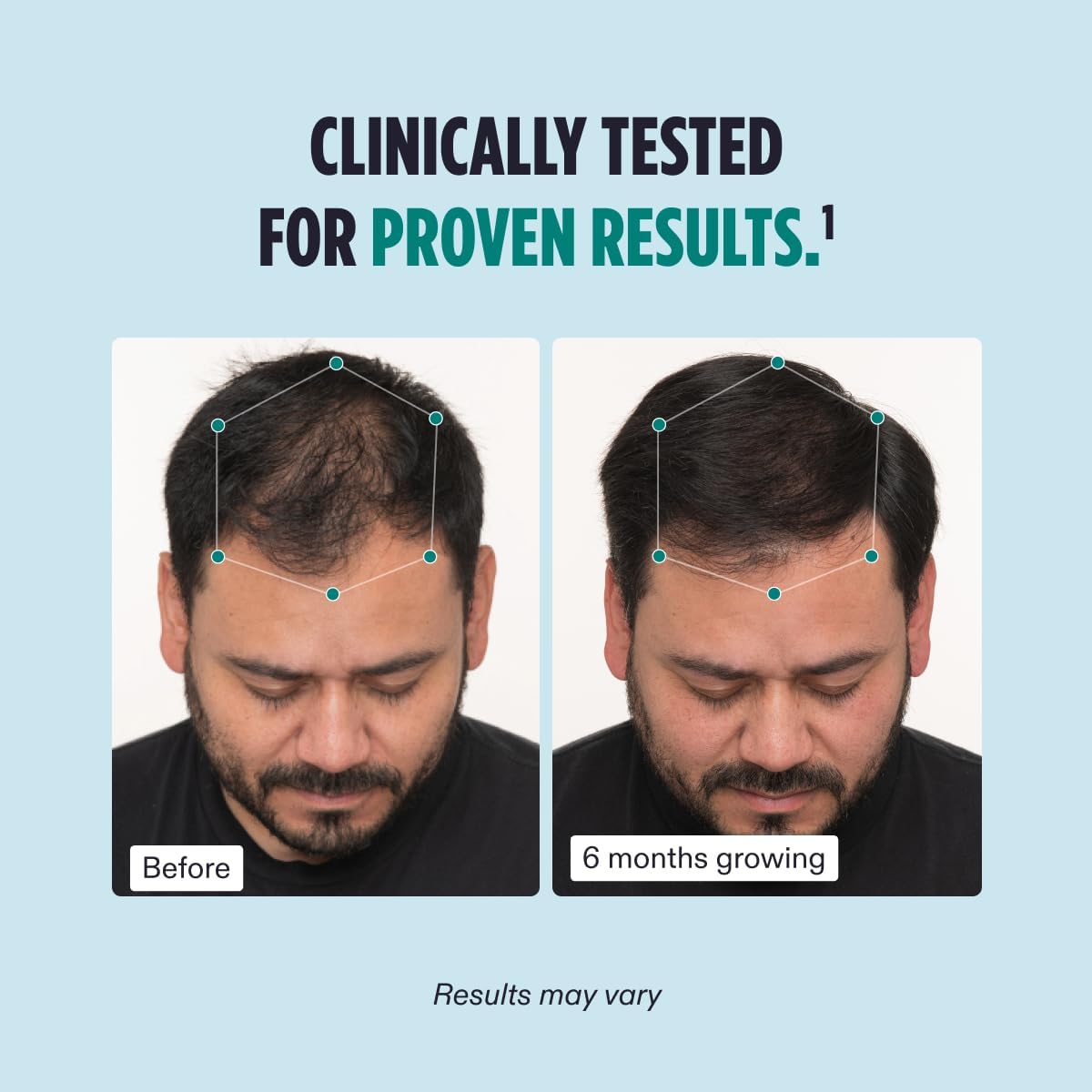 Nutrafol Men&