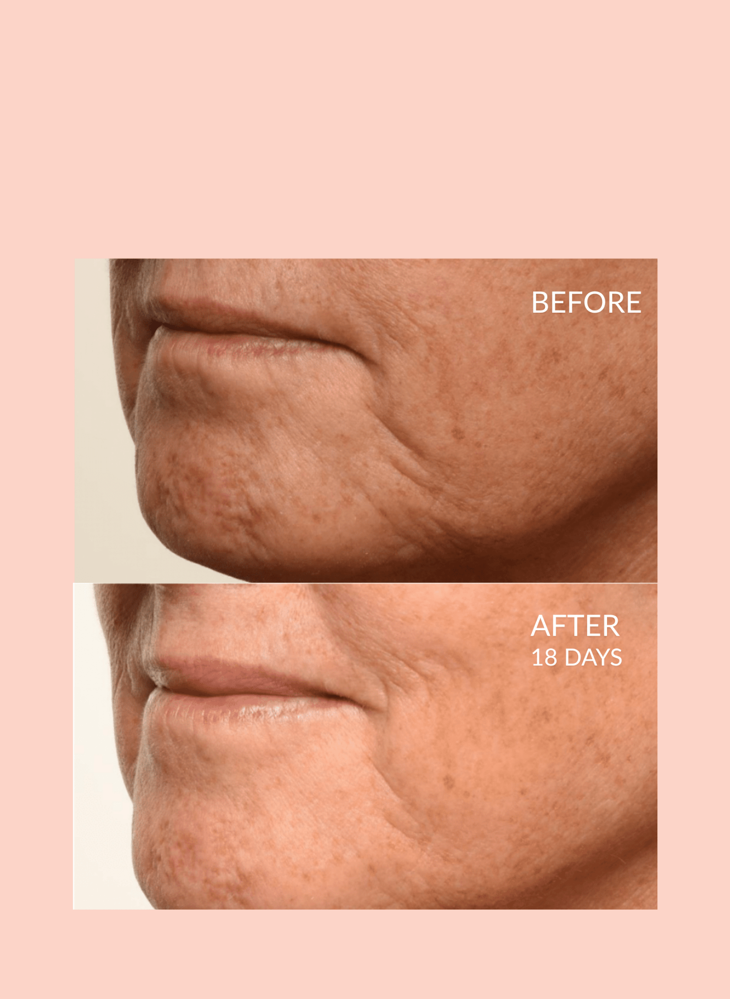 Theorem Serum Boost by Caire Beauty