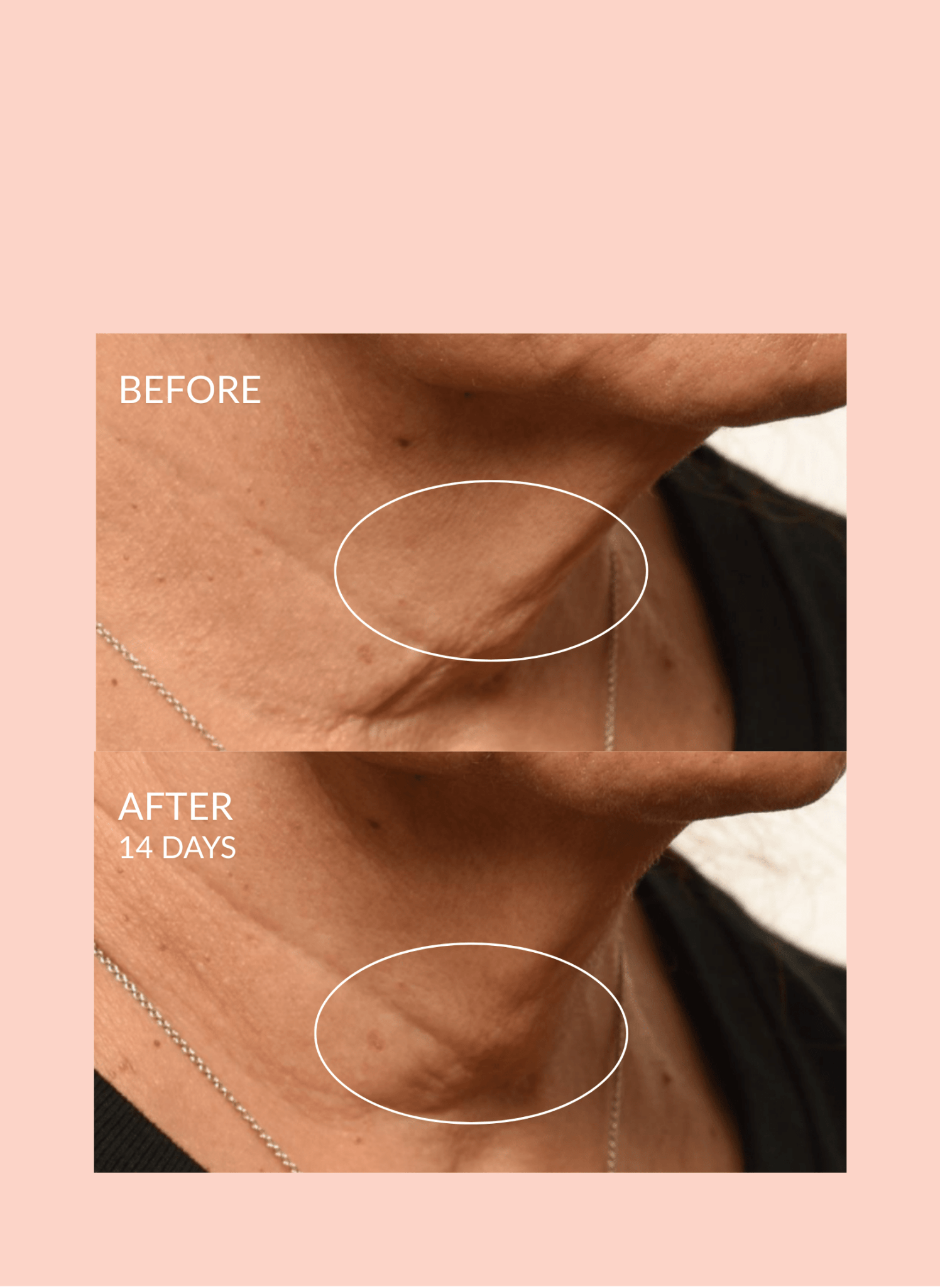 Theorem Serum Boost by Caire Beauty